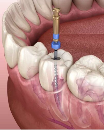 Treatment - cathedraldental