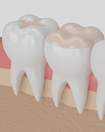 Treatment - cathedraldental