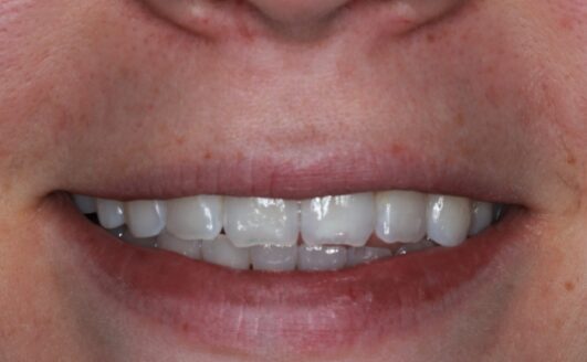 Before - cathedraldental1