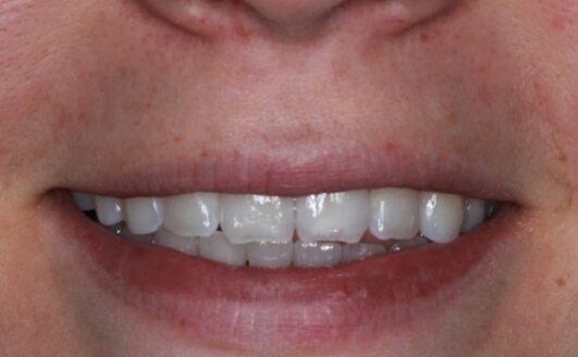 Before - catherdaldental1